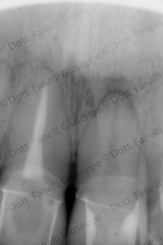 Endodonzia 2 Endodonzia 2