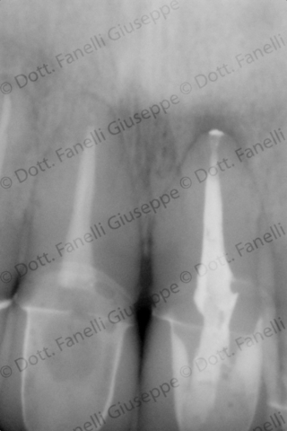 Endodonzia 1 Endodonzia 1