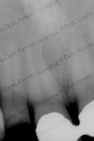Endodonzia 3 Endodonzia 3